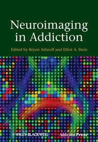 Neuroimaging in Addiction,  аудиокнига. ISDN33816454