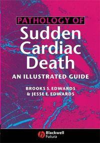Pathology of Sudden Cardiac Death - Brooks Edwards
