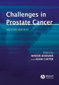 Challenges in Prostate Cancer, Winsor  Bowsher аудиокнига. ISDN43524887
