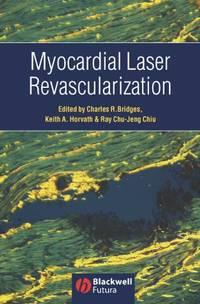 Myocardial Laser Revascularization, Charles  Bridges аудиокнига. ISDN43527743