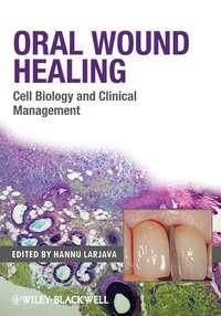 Oral Wound Healing. Cell Biology and Clinical Management, Hannu  Larjava Hörbuch. ISDN31219145