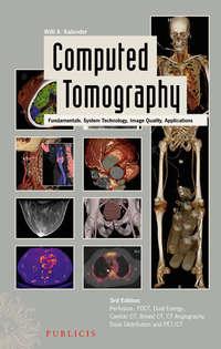 Computed Tomography. Fundamentals, System Technology, Image Quality, Applications - Willi Kalender