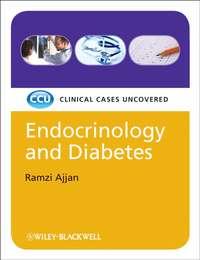 Endocrinology and Diabetes, eTextbook. Clinical Cases Uncovered, Ramzi  Ajjan аудиокнига. ISDN31219777