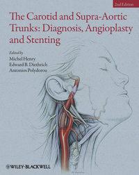The Carotid and Supra-Aortic Trunks. Diagnosis, Angioplasty and Stenting, Michel  Henry аудиокнига. ISDN31219865