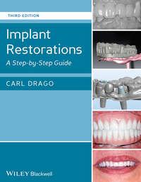 Implant Restorations. A Step-by-Step Guide, Carl  Drago audiobook. ISDN31220329