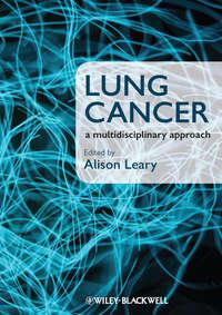 Lung Cancer. A Multidisciplinary Approach, Alison  Leary аудиокнига. ISDN31222097