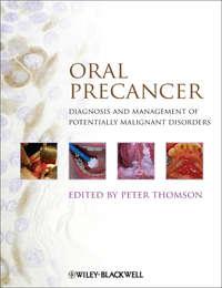 Oral Precancer. Diagnosis and Management of Potentially Malignant Disorders, Peter  Thomson książka audio. ISDN31224337
