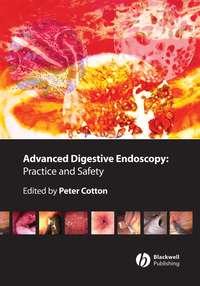 Advanced Digestive Endoscopy. Practice and Safety - Peter Cotton
