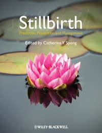 Stillbirth. Prediction, Prevention and Management - Catherine Spong
