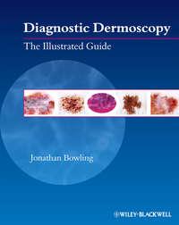 Diagnostic Dermoscopy. The Illustrated Guide - Jonathan Bowling