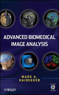 Advanced Biomedical Image Analysis, Mark  Haidekker audiobook. ISDN31233633