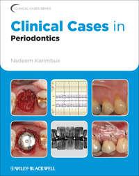 Clinical Cases in Periodontics, Nadeem  Karimbux audiobook. ISDN31233729