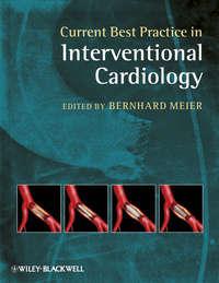 Current Best Practice in Interventional Cardiology, Bernhard  Meier аудиокнига. ISDN31236377