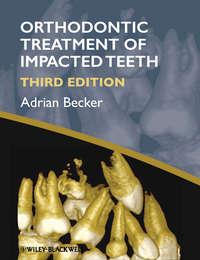 Orthodontic Treatment of Impacted Teeth, Adrian  Becker аудиокнига. ISDN31240097