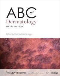 ABC of Dermatology, Rachael  Morris-Jones аудиокнига. ISDN31242881