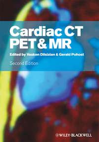 Cardiac CT, PET and MR - Pohost Gerald