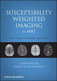 Susceptibility Weighted Imaging in MRI. Basic Concepts and Clinical Applications,  аудиокнига. ISDN33818566