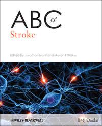 ABC of Stroke,  książka audio. ISDN33820366