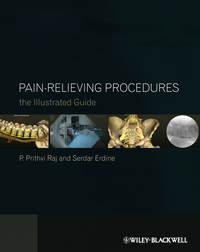 Pain-Relieving Procedures. The Illustrated Guide - Erdine Serdar