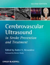 Cerebrovascular Ultrasound in Stroke Prevention and Treatment - Hacke Werner