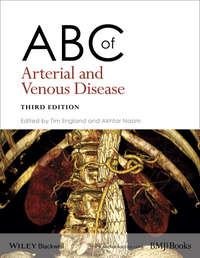 ABC of Arterial and Venous Disease,  książka audio. ISDN33821774
