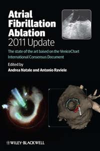 Atrial Fibrillation Ablation, 2011 Update. The State of the Art based on the VeniceChart International Consensus Document,  audiobook. ISDN33822526