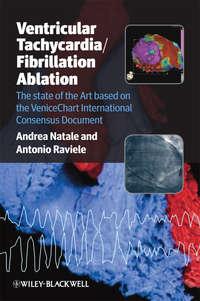 Ventricular Tachycardia / Fibrillation Ablation. The state of the Art based on the VeniceChart International Consensus Document,  аудиокнига. ISDN33822534