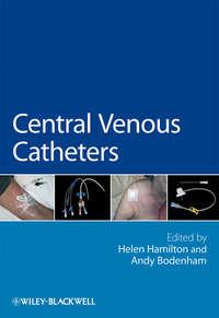 Central Venous Catheters - Bodenham Andy