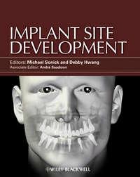 Implant Site Development,  аудиокнига. ISDN33824254