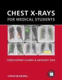 Chest X-rays for Medical Students,  аудиокнига. ISDN33824710