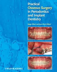 Practical Osseous Surgery in Periodontics and Implant Dentistry - Dibart Jean-Pierre