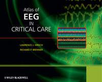 Atlas of EEG in Critical Care - Brenner Richard