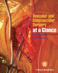 Vascular and Endovascular Surgery at a Glance - Stephenson Matthew