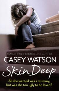 Skin Deep: All She Wanted Was a Mummy, But Was She Too Ugly to Be Loved?, Casey  Watson audiobook. ISDN39768433