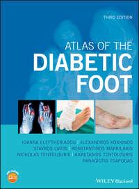Atlas of the Diabetic Foot, Panagiotis  Tsapogas аудиокнига. ISDN42166091