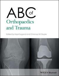 ABC of Orthopaedics and Trauma, Kapil  Sugand Hörbuch. ISDN43442898