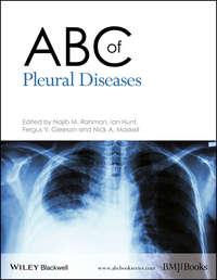 ABC of Pleural Diseases, Ian  Hunt аудиокнига. ISDN43442922
