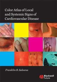 Color Atlas of Local and Systemic Manifestations of Cardiovascular Disease,  аудиокнига. ISDN43509704