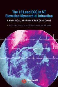 The 12 Lead ECG in ST Elevation Myocardial Infarction, Miquel  Fiol-Sala audiobook. ISDN43509816