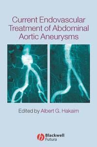 Current Endovascular Treatment of Abdominal Aortic Aneurysms - Сборник