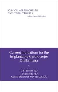 Current Indications for the Implantable Cardioverter Defibrillator, Gunter  Breithardt audiobook. ISDN43509968