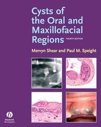 Cysts of the Oral and Maxillofacial Regions, Mervyn  Shear аудиокнига. ISDN43510032