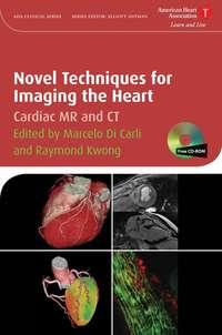Novel Techniques for Imaging the Heart,  аудиокнига. ISDN43510512