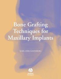 Bone Grafting Techniques for Maxillary Implants,  książka audio. ISDN43510664