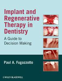 Implant and Regenerative Therapy in Dentistry - Сборник