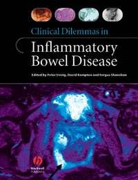 Clinical Dilemmas in Inflammatory Bowel Disease, Fergus  Shanahan audiobook. ISDN43510848