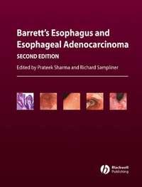 Barretts Esophagus and Esophageal Adenocarcinoma, Prateek  Sharma audiobook. ISDN43510880