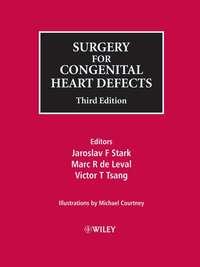 Surgery for Congenital Heart Defects - Michael Courtney