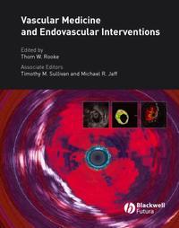 Vascular Medicine and Endovascular Interventions,  audiobook. ISDN43511456