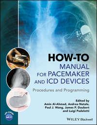 How-to Manual for Pacemaker and ICD Devices - Andrea Natale